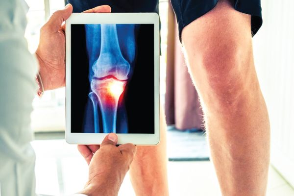 artroza liječenje gimnastika ramenog zgloba