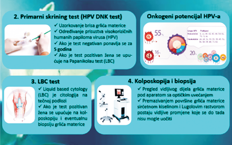 Karcinom grlića materice – bolest koja se može spriječiti