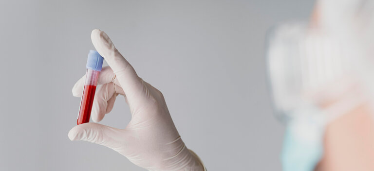 Kada i za&scaron;to trudnica treba da bude imunohematolo&scaron;ki testirana